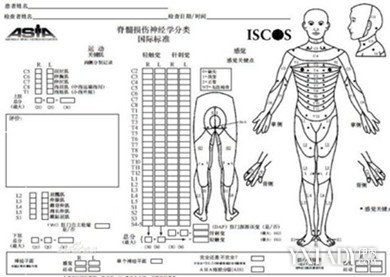 【图】肌力分级的评定标准是什么 专家让你一清